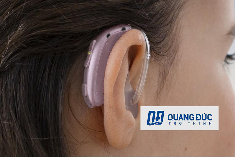 Tìm Hiểu Máy trợ thính bao nhiêu tiền tại Hồ Chí Minh?
