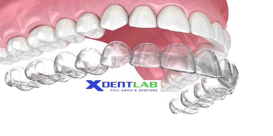 Custom clear aligner production