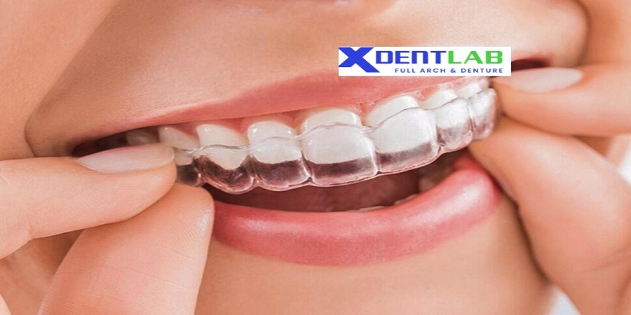 Global OEM clear aligner services
