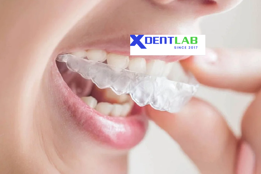 Global 3D printed aligners provider