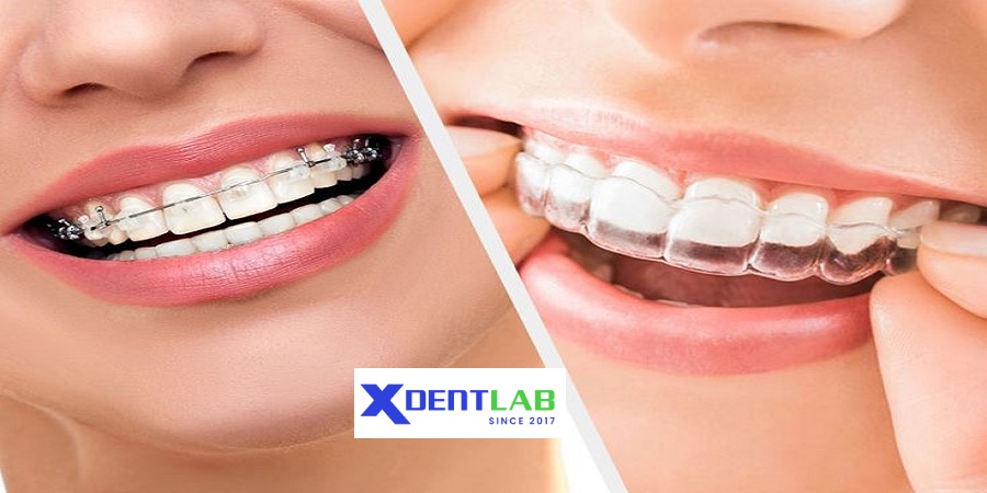 Orthodontic aligner provider