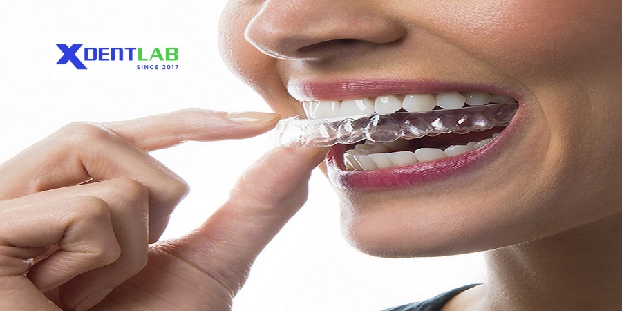 Wholesale clear aligners