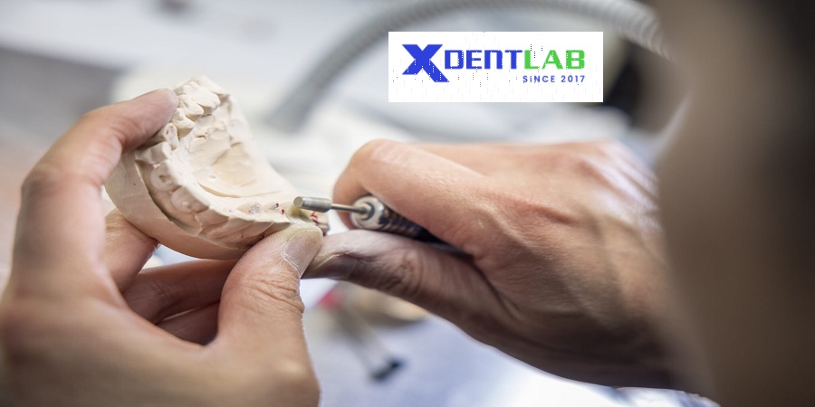 Vietnam dental laboratory District 6 Ho Chi Minh