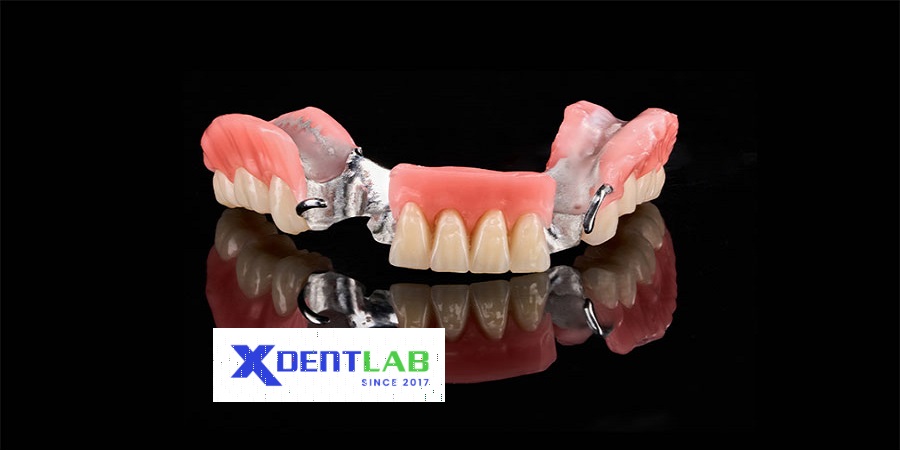 Removable Denture Lab District 9 Ho Chi Minh