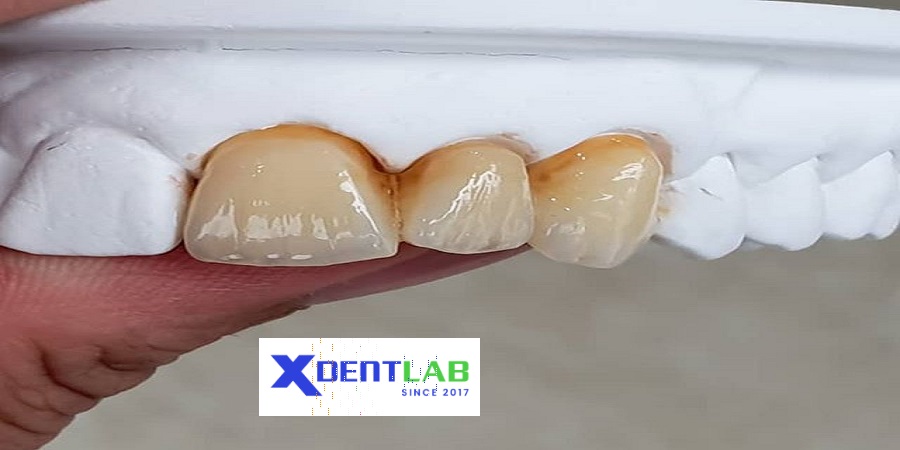 Vietnam dental laboratories district 2 Ho Chi Minh