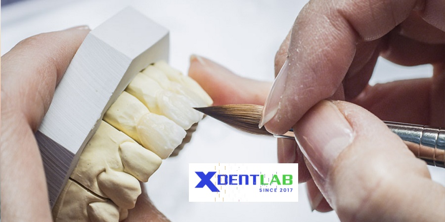 Vietnam dental laboratories district 6 Ho Chi Minh